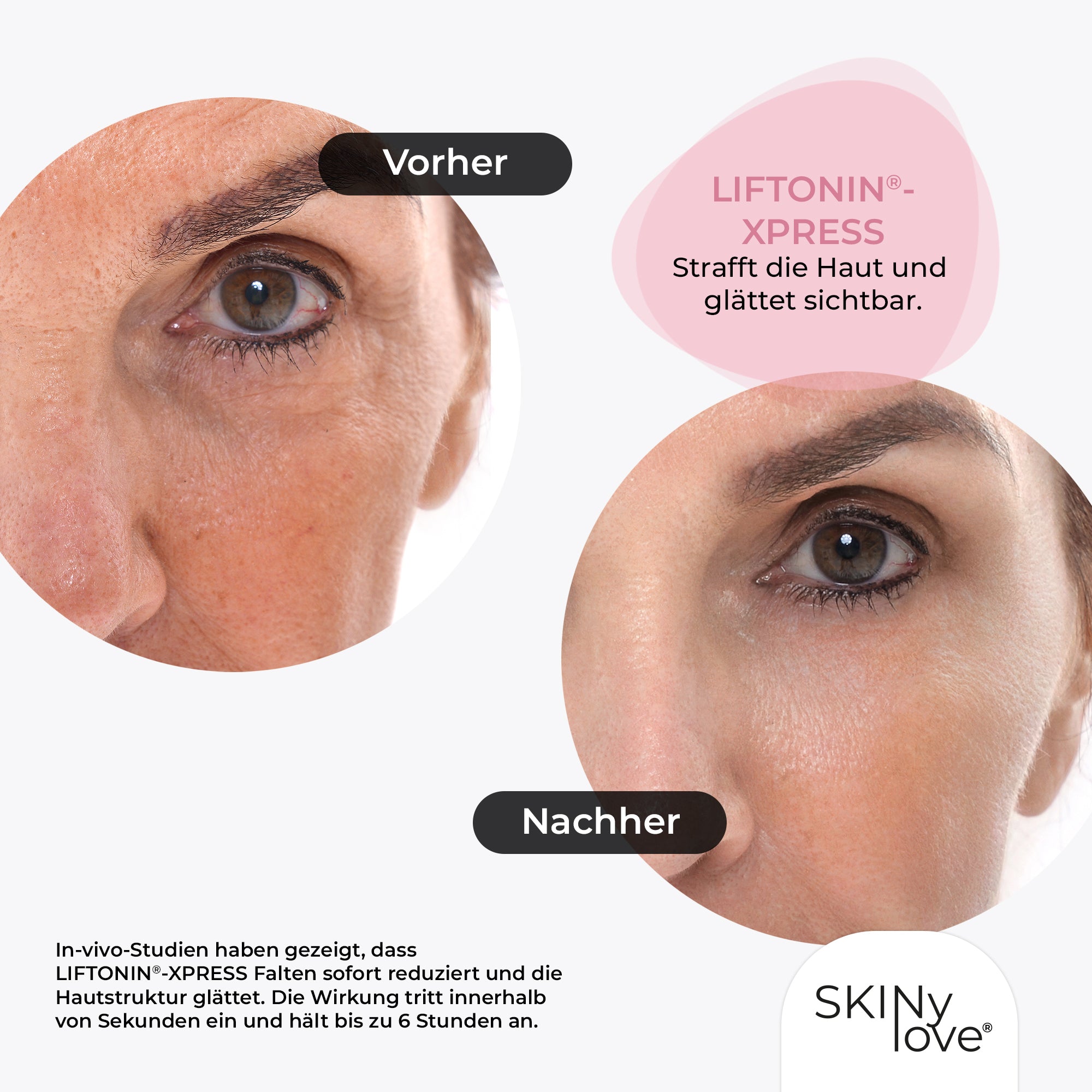 SKINylove® Beautox Roll-On Serum (10 ml) – Sofortige Glättung und Anti-Aging-Pflege für die Augenpartie