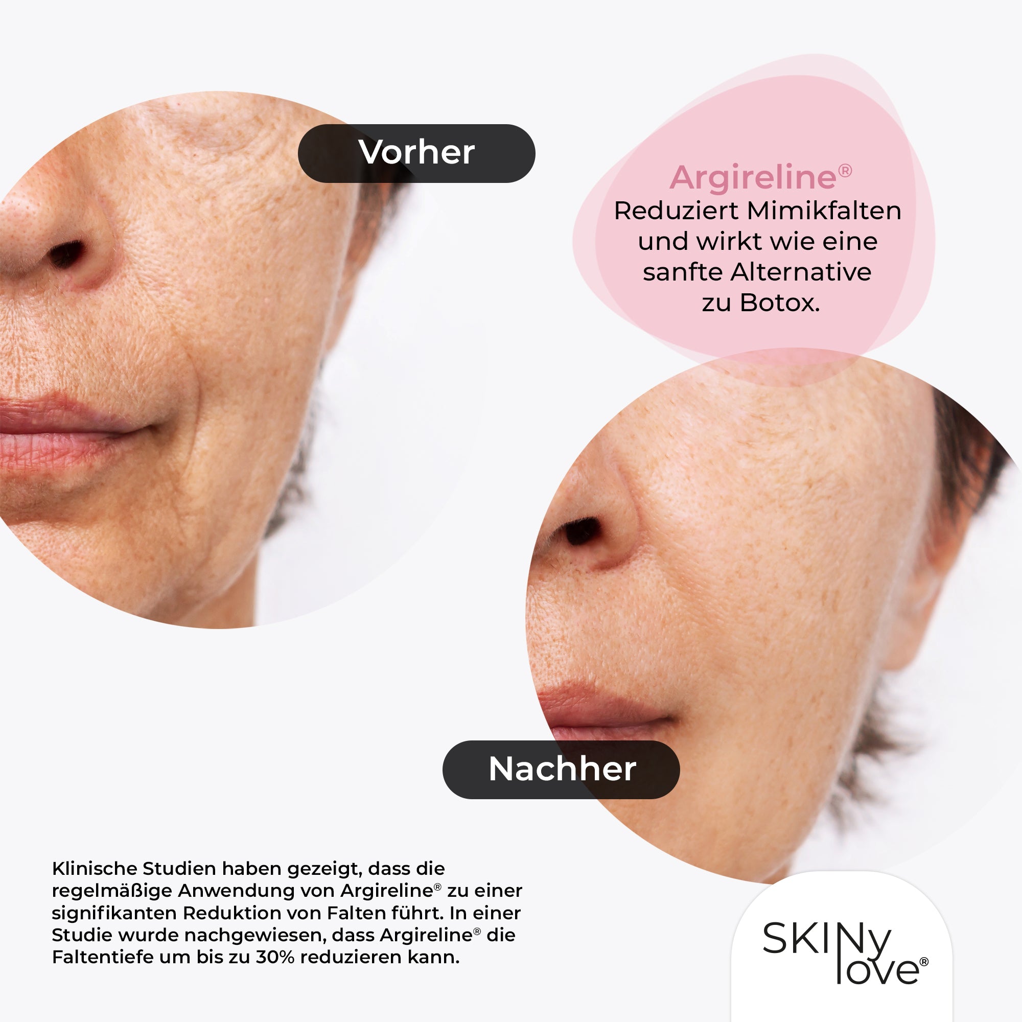 SKINylove® Beautox Serum 30ml – Anti-Aging-Power für jugendlich glatte Haut!