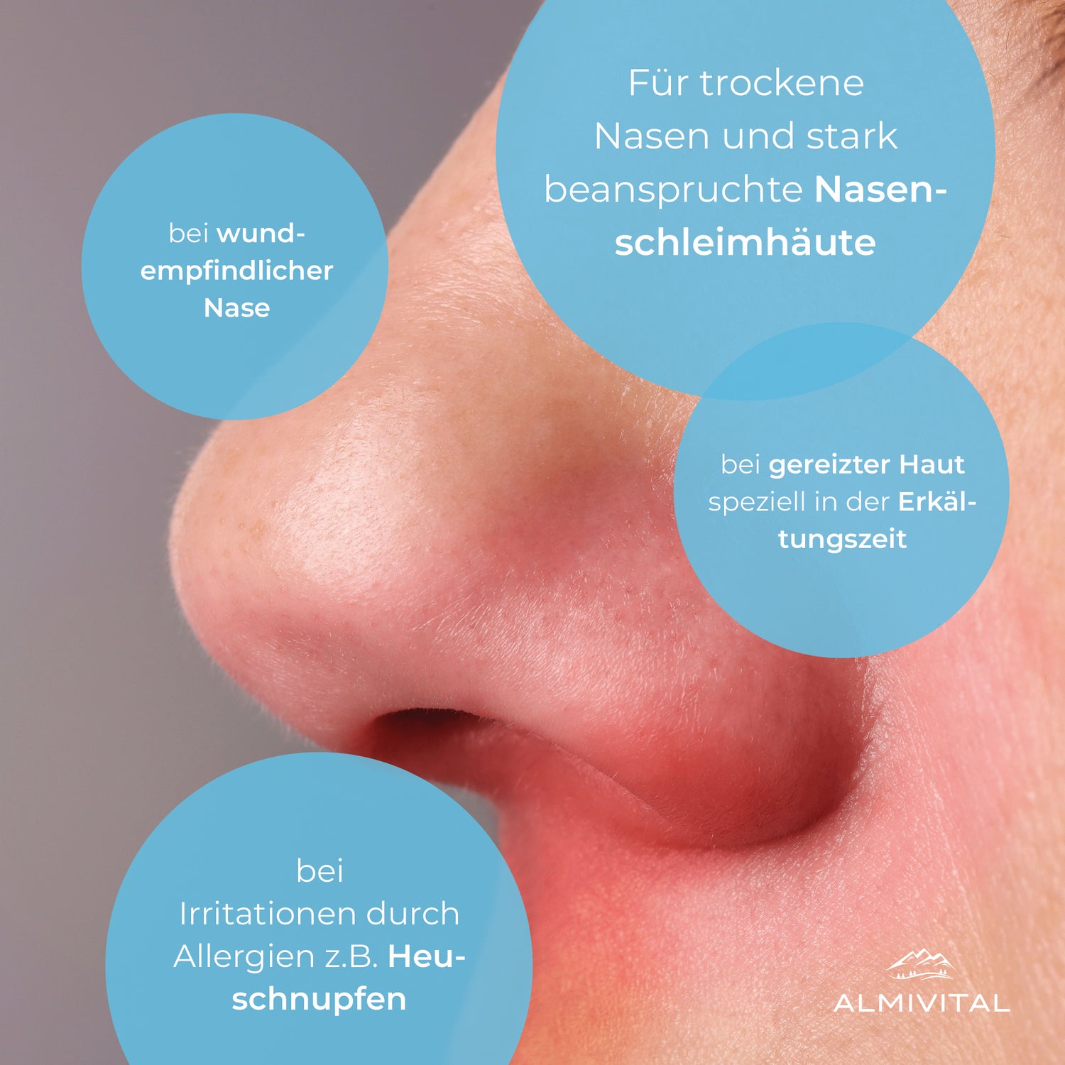 ALMIVITAL Hylointense Nasensalbe 100 ml – Sanfte Pflege für wunde Nasen