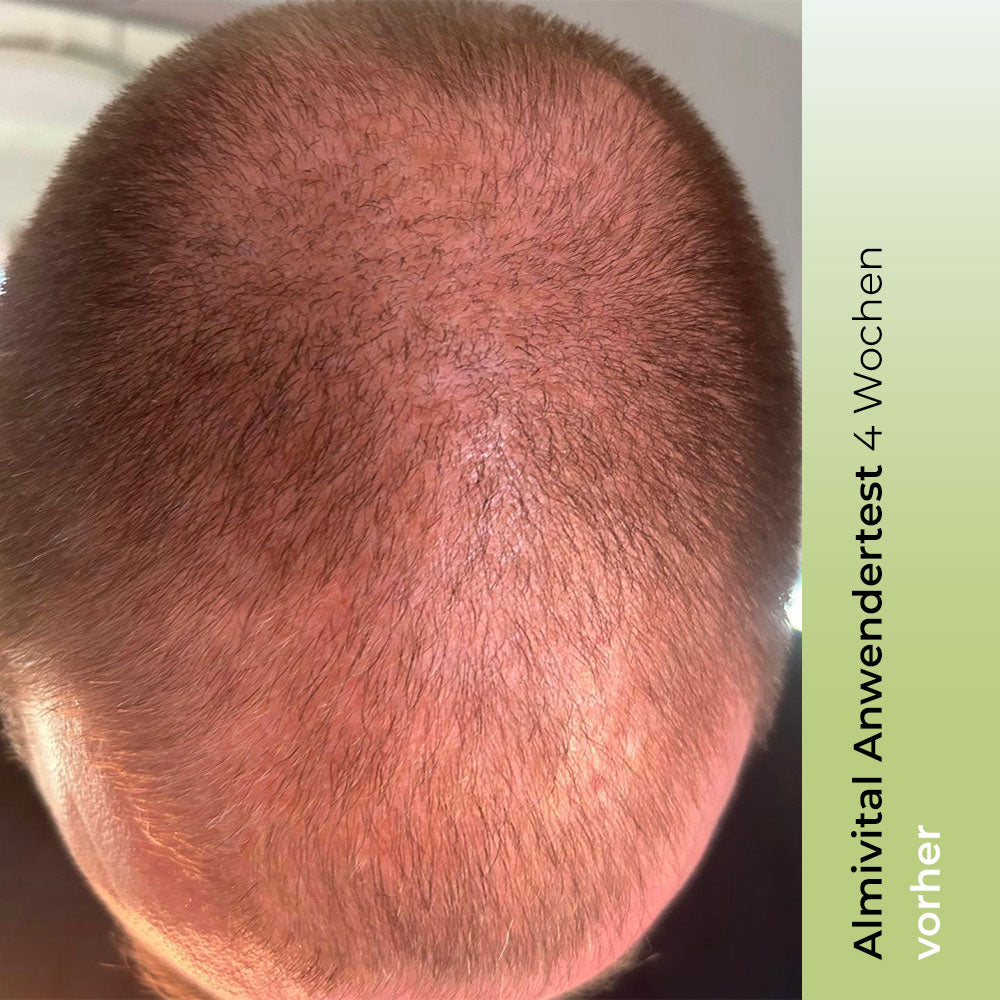 ALMIVITAL Haarkraft Tonic mit AnaGain™ und RootBioTec™ 100ml