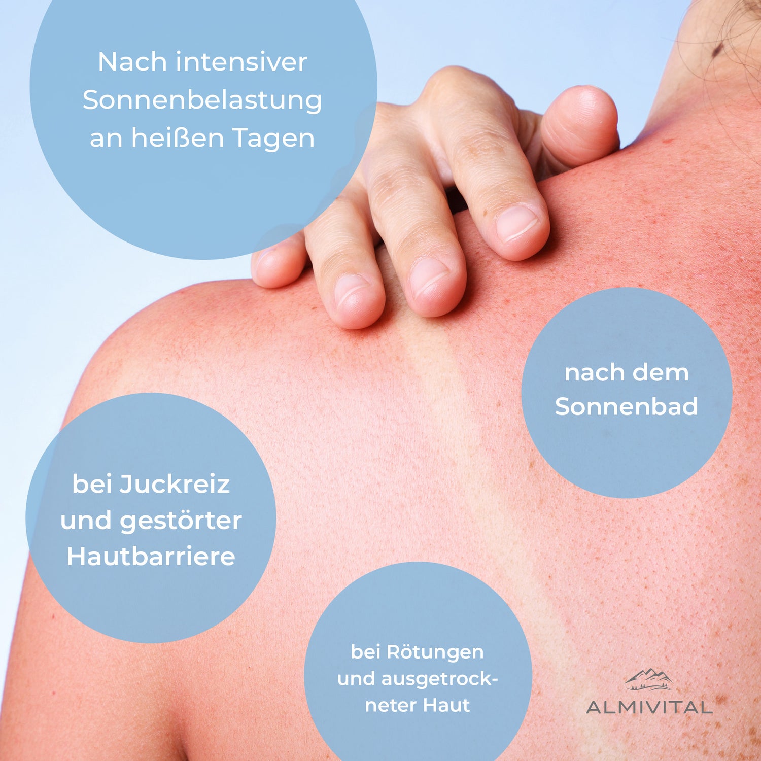 ALMIVITAL After Sun Gel – Sanfte Soforthilfe für sonnengestresste Haut 200ml