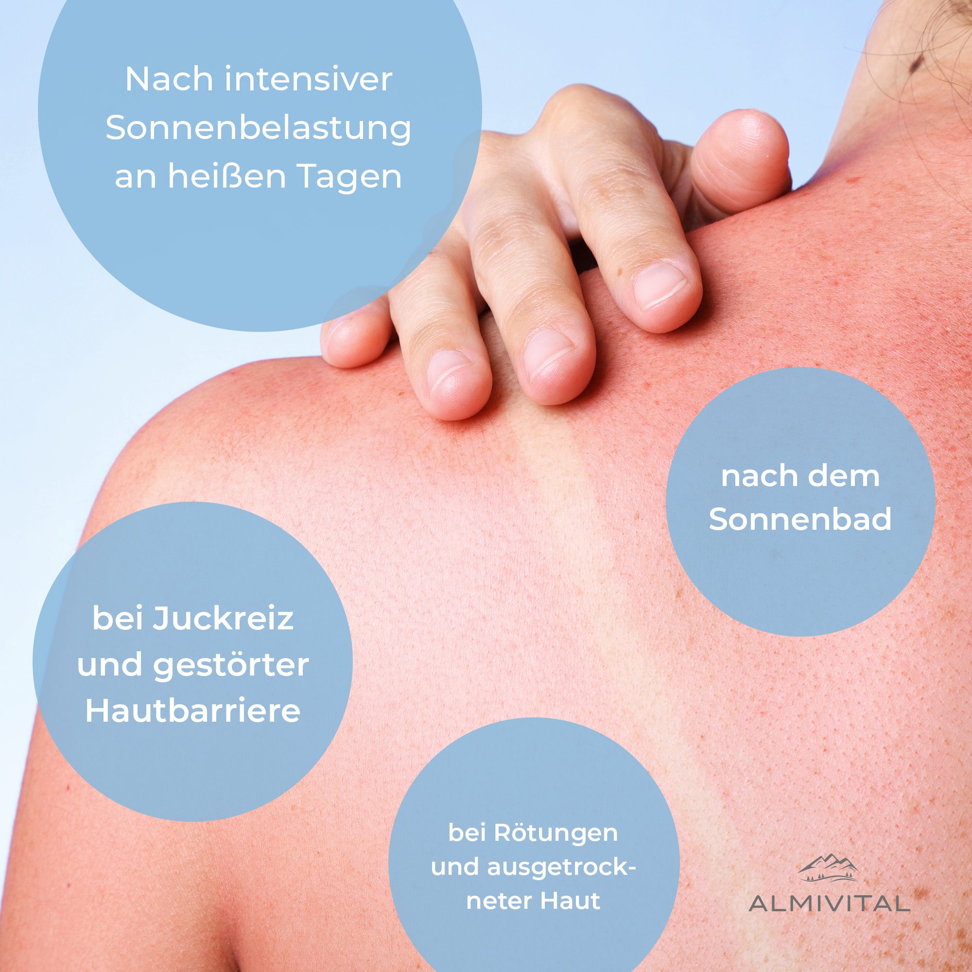 ALMIVITAL After Sun Gel – Sanfte Soforthilfe für sonnengestresste Haut 200ml