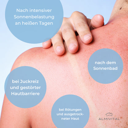 ALMIVITAL After Sun Gel – Sanfte Soforthilfe für sonnengestresste Haut 200ml