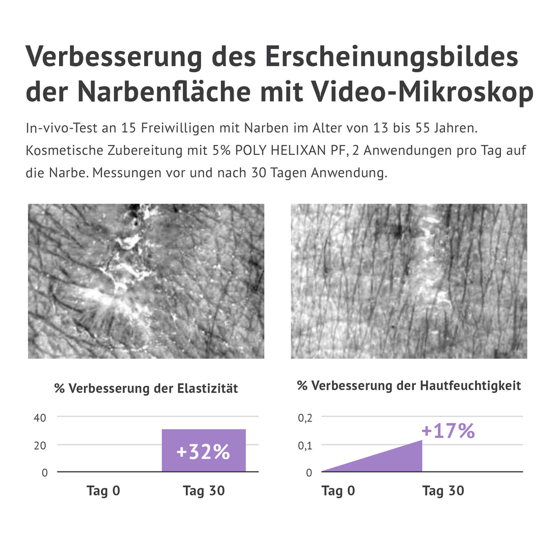 ALMIVITAL Narben Pflege Serum 100 ml – Sanfte und effektive Pflege für Narben